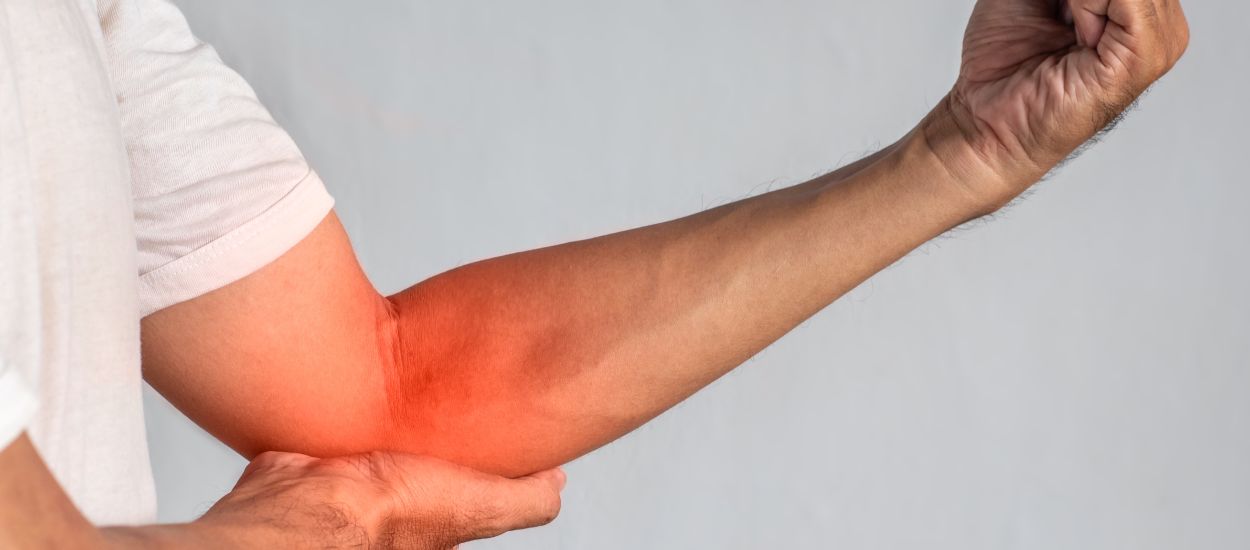 What is a Distal Biceps Rupture?