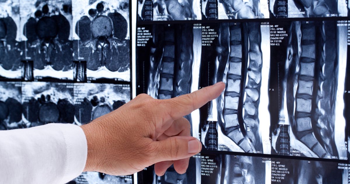 CT vs MRI: Key Differences Explained